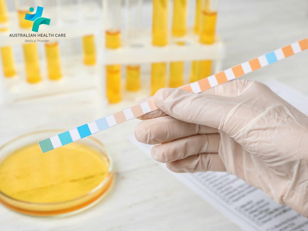 Understanding Urinalysis Test Strips
