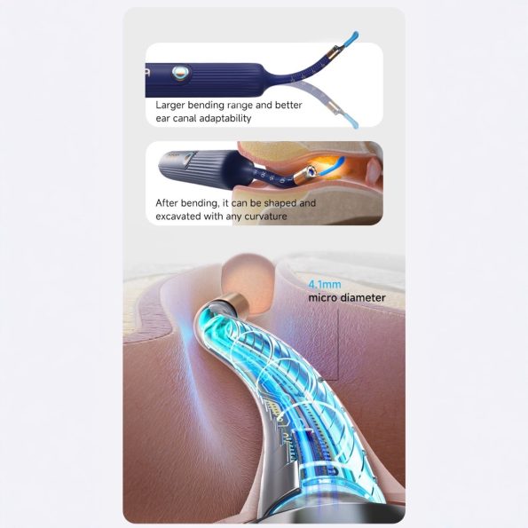 Smart Visual Ear Cleaner with HD Endoscope & Precision Tweezers - Safe for Adults & Children(blue) - Image 5