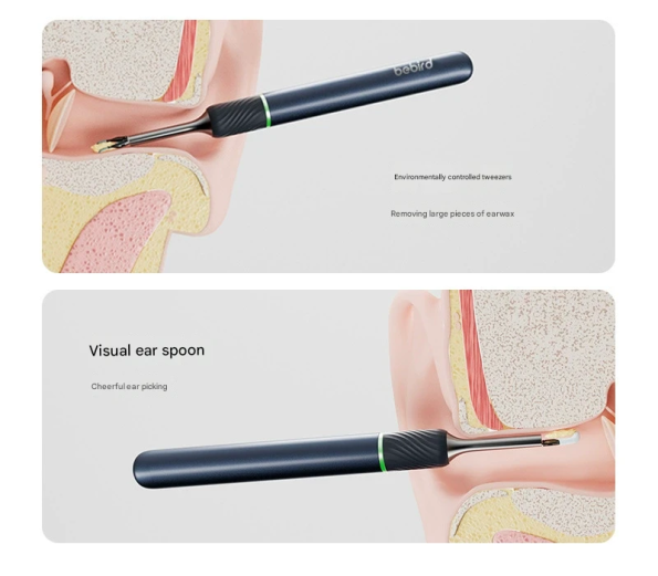 Smart Visual Ear Cleaner with HD Endoscope & Precision Tweezers - Safe for Adults & Children(Dark blue) - Image 4