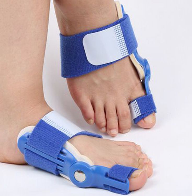 2 x Bunion Corrector for Women and Men, Orthopedic Bunion Toe Straightener, Toe Correctors for Bent Toes, Adjustable Bunion